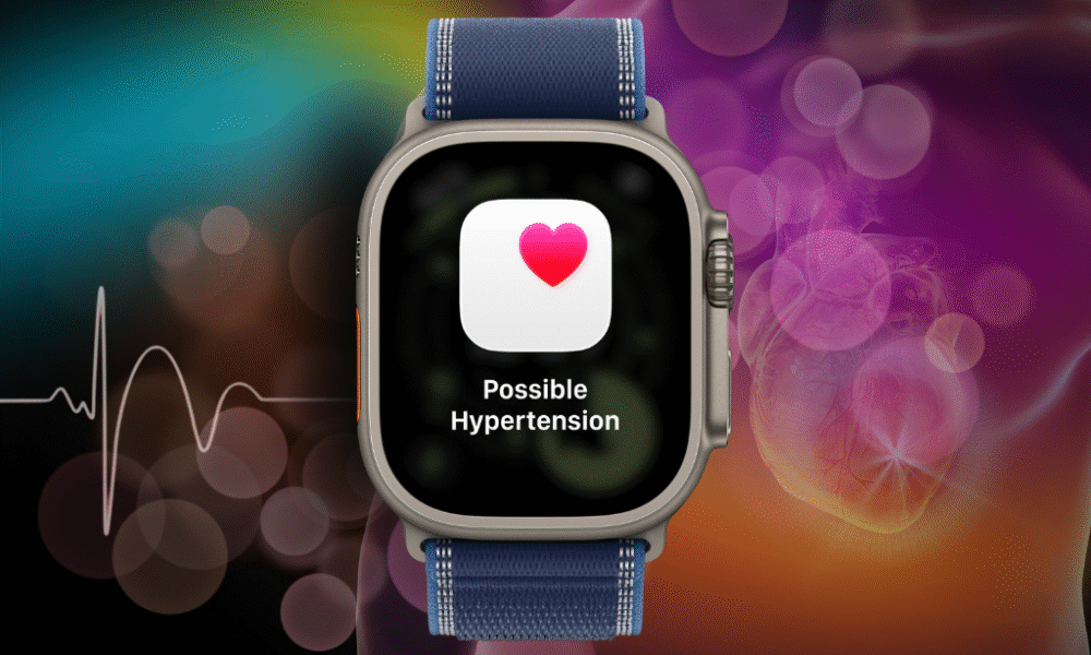 Apple Watch Ultra 3