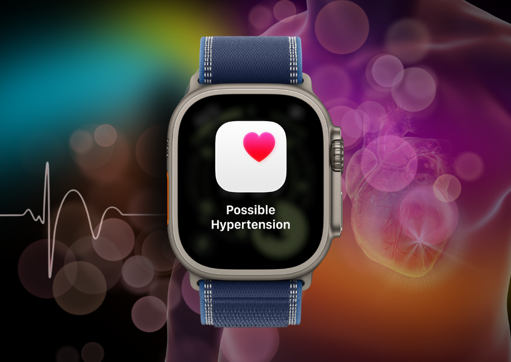 Apple Watch's Game-Changing Hypertension Feature: Your Silent Health Guardian in watchOS 26 85 Apple Watch Ultra 3